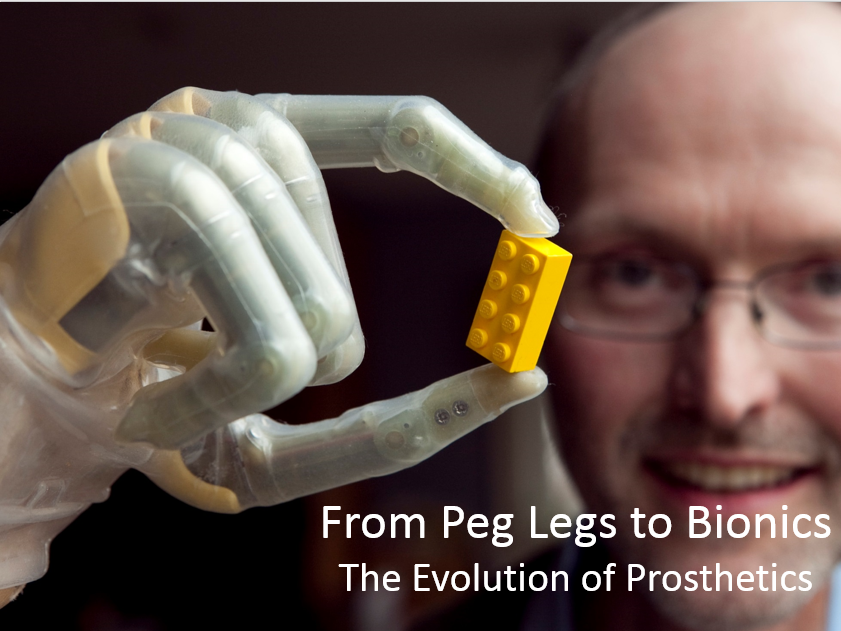 The Evolution of Prosthetics